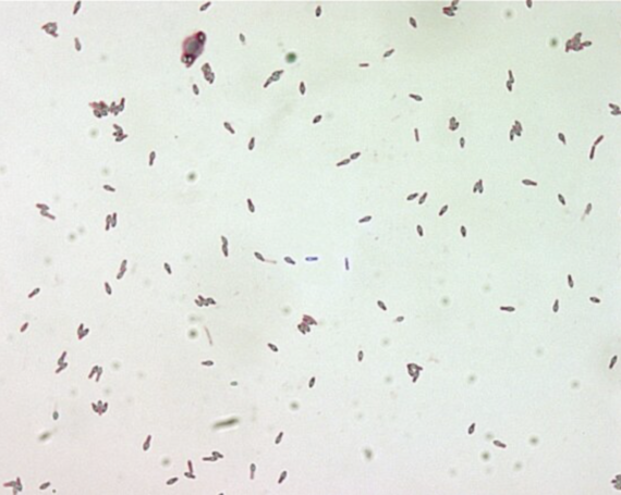Perché il Clostridium botulinum produce una delle tossine più potenti della natura